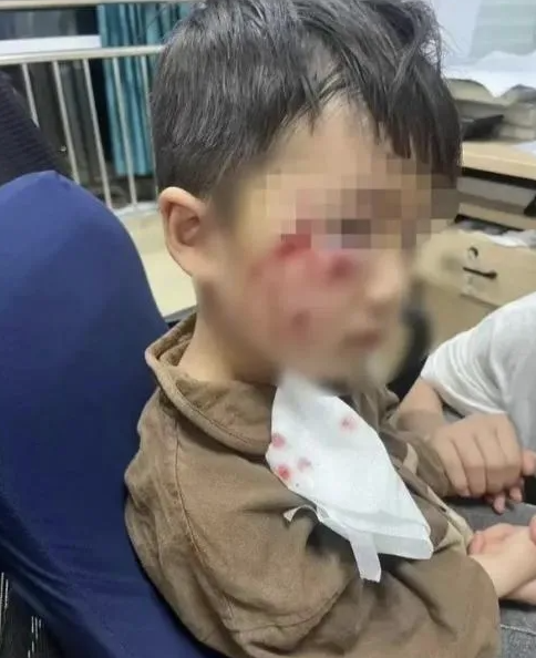 被瘋?cè)麤](méi)有“救命藥”，怎么辦？